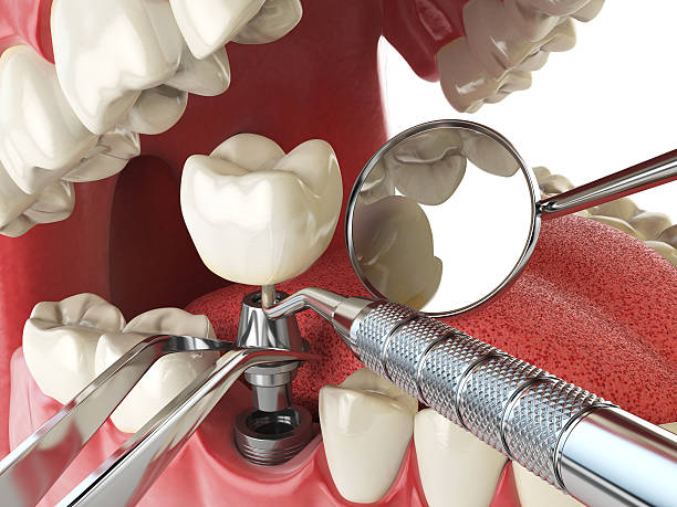 Best Emergency Tooth Extraction  in Laurens, SC